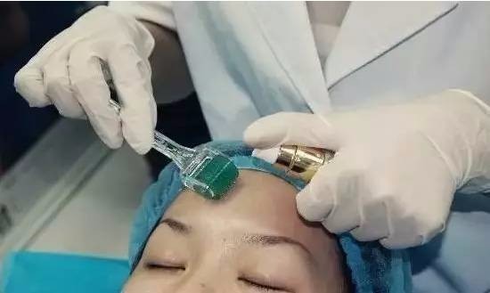 果酸換膚成本與代價揭秘，美麗背后的價格標(biāo)簽